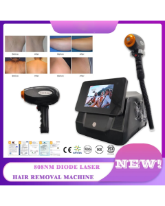 Diodenlaser Haaren tfernungs maschine