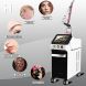 Q-Switch Pico Laser Gerät zur Tattoo- und Pigmententfernung