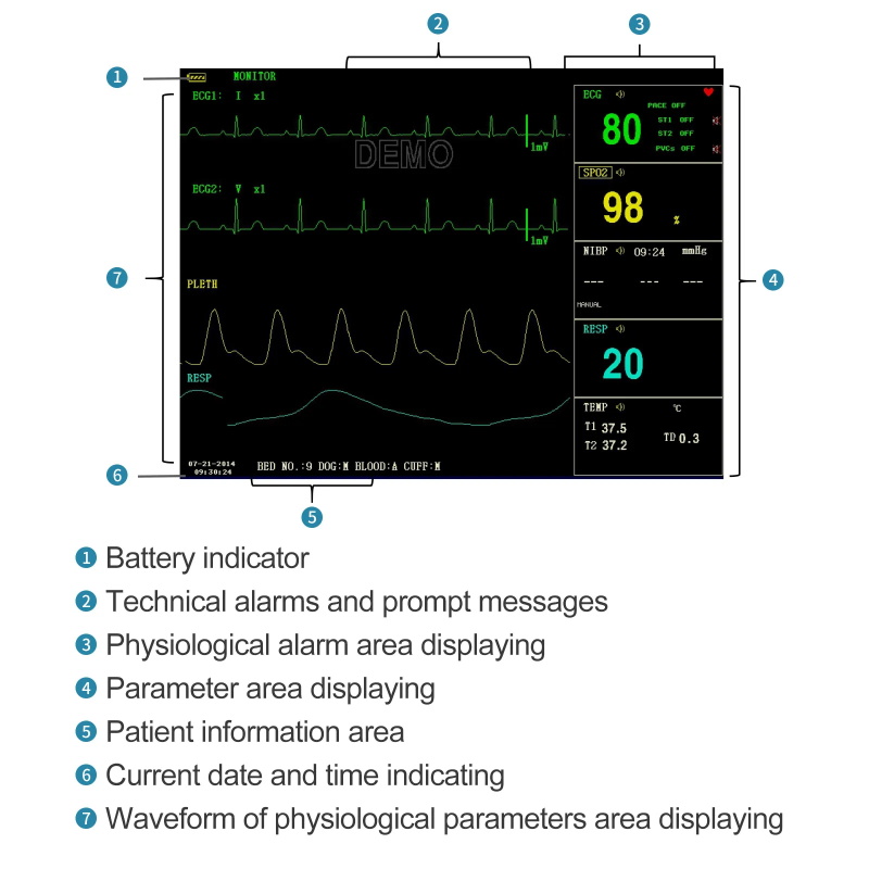 Portable patient monitor