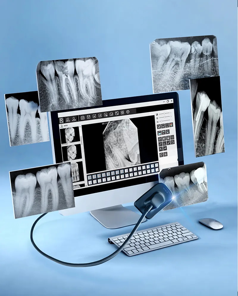 dental x-ray